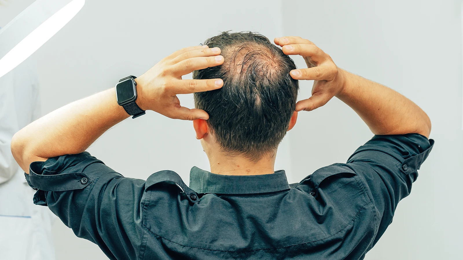 Balding? 3 Tips For Single Guys in 2024